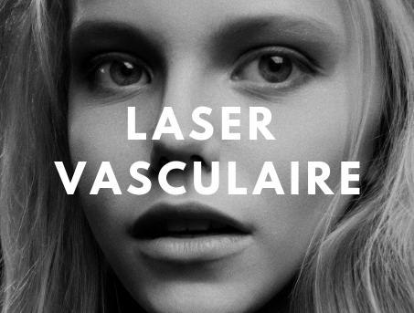 laser vasculaire