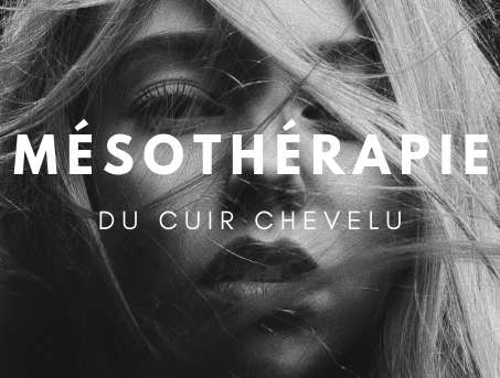 mesotherapie du cuir chevelu