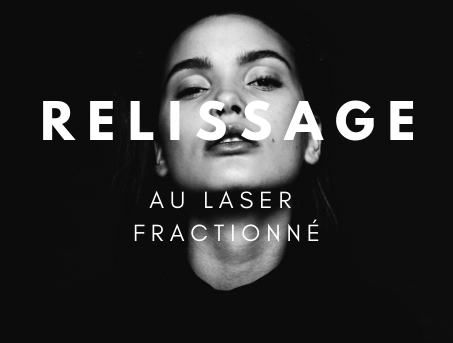 relissage laser fractionne